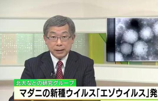 日本發現能傳染人類新病毒,已有多人感染Yezo病毒
