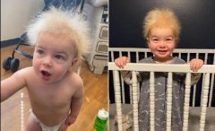 美國男嬰患罕見難梳頭發綜合征,寶寶對準它自己慢慢動